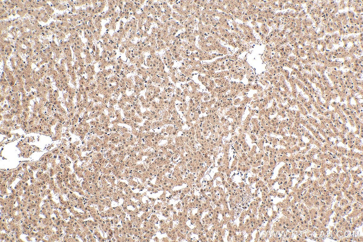 IHC staining of human liver using 20797-1-AP