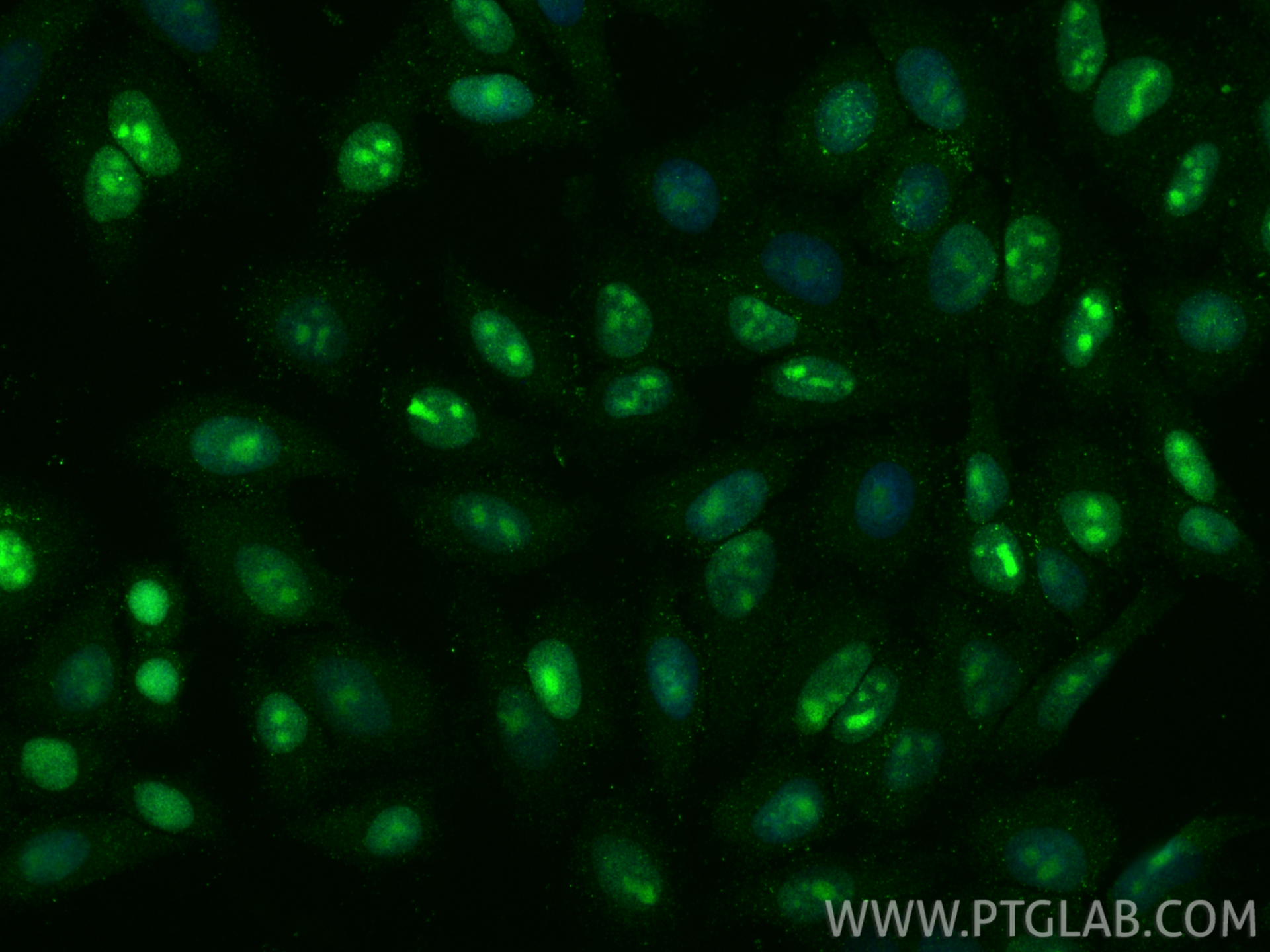 Immunofluorescent analysis of (4% PFA) fixed HepG2 cells using C7orf50 antibody (68494-1-Ig, Clone: 2A3G5 ) at dilution of 1:1200 and CoraLite®488-Conjugated Goat Anti-Mouse IgG(H+L) (<a class='green' href='/productredirect?CatalogNo=SA00013-1' target='_blank'>SA00013-1</a>). IF Staining of HepG2 using 68494-1-Ig