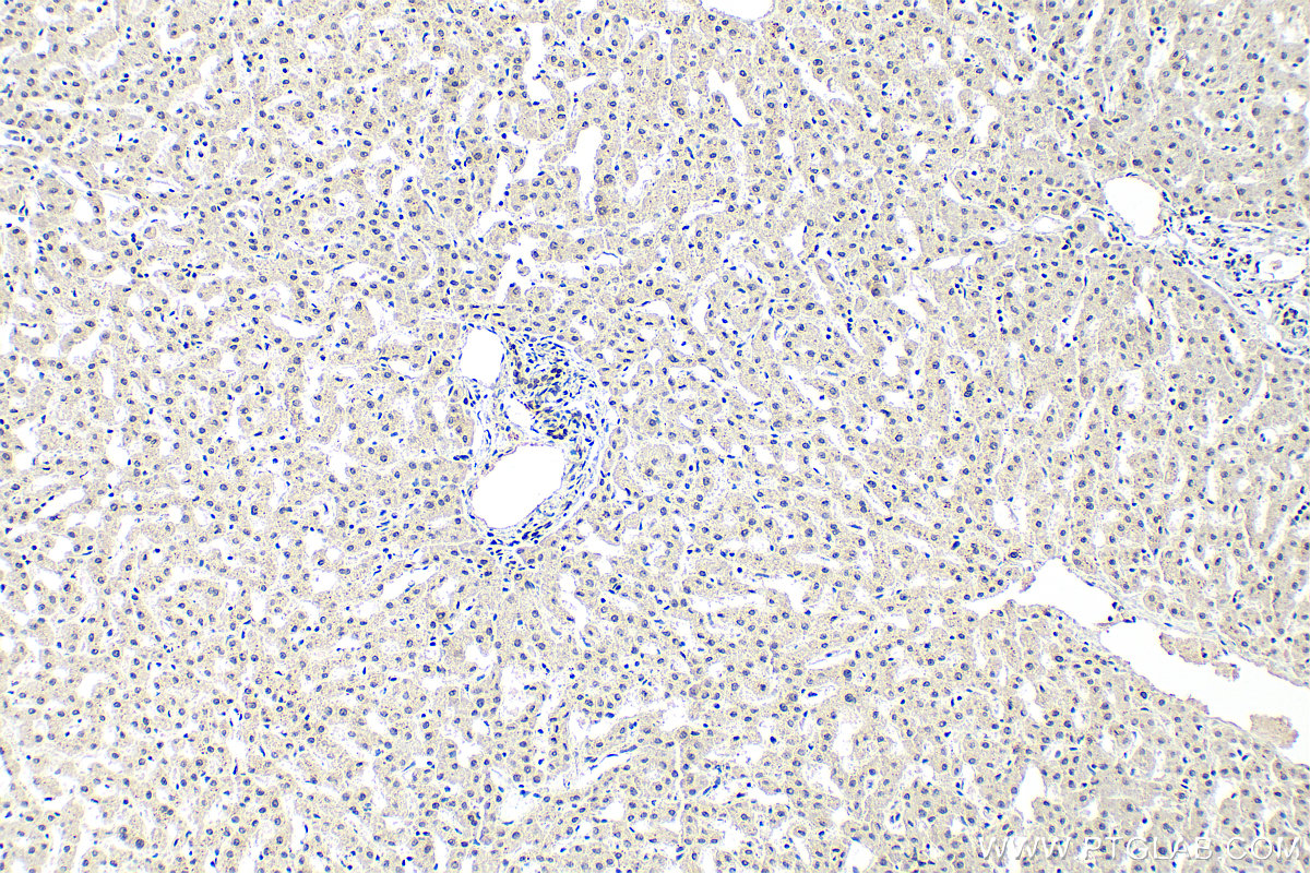 Immunohistochemical analysis of paraffin-embedded human liver tissue slide using 68494-1-Ig (C7orf50 antibody) at dilution of 1:400 (under 10x lens). Heat mediated antigen retrieval with Tris-EDTA buffer (pH 9.0). IHC staining of human liver using 68494-1-Ig