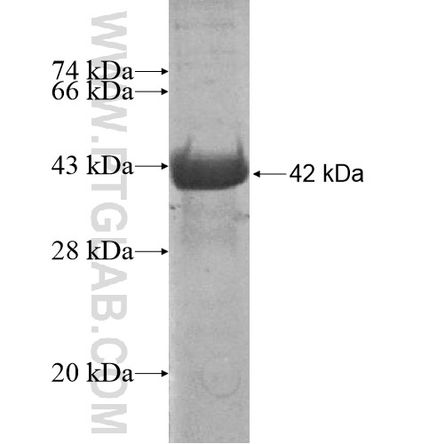 C7orf58 fusion protein Ag15623 SDS-PAGE C7orf58 fusion protein Ag15623 SDS-PAGE