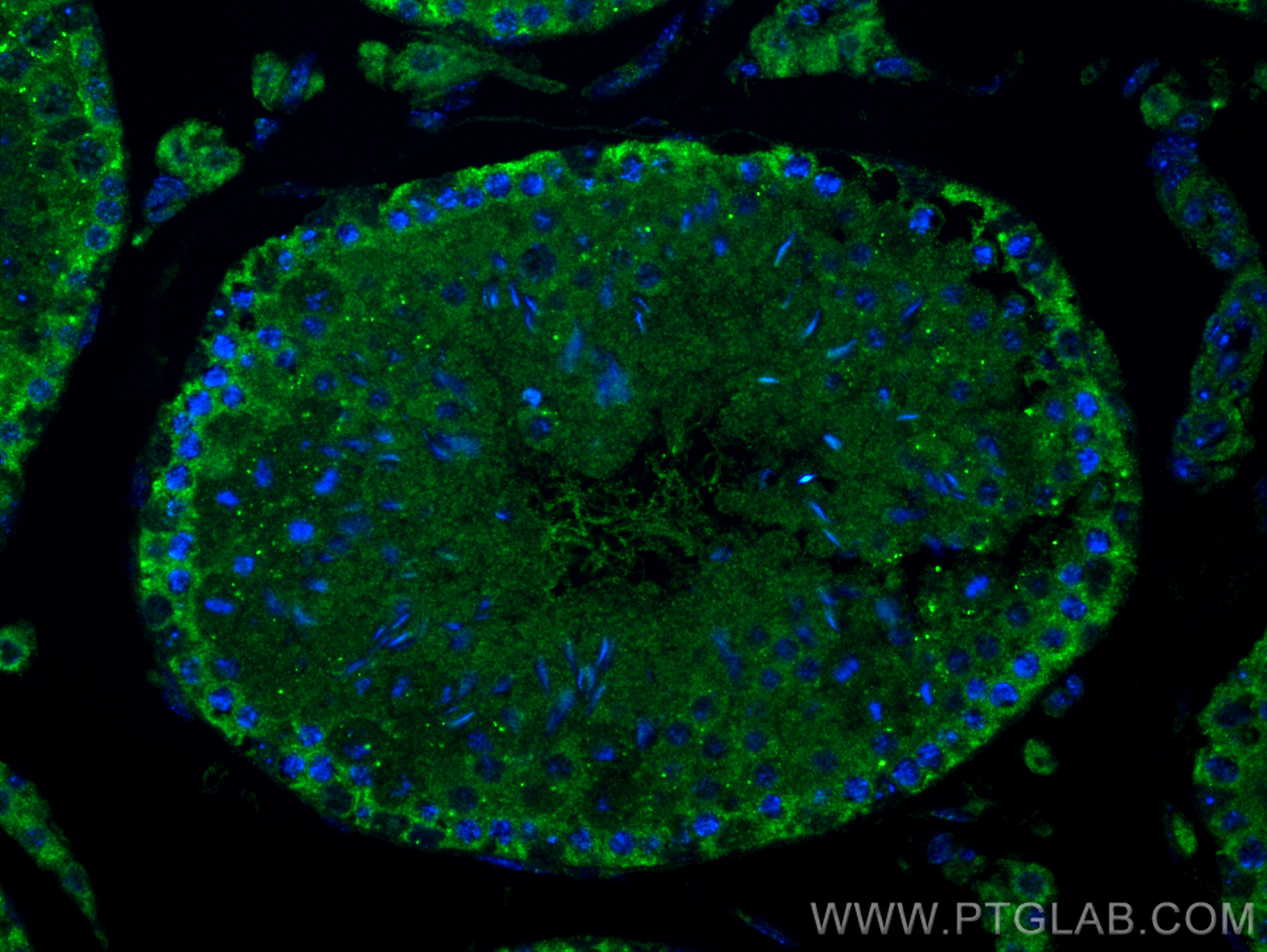 IF Staining of mouse testis using 24001-1-AP
