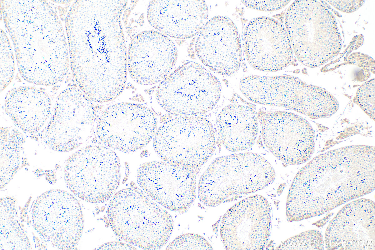 IHC staining of mouse testis using 24001-1-AP