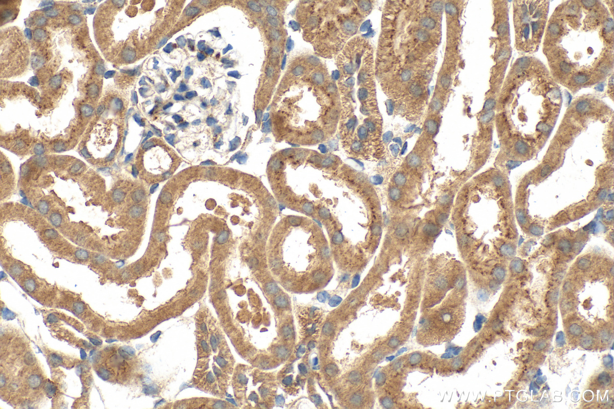 IHC staining of mouse kidney using 15587-1-AP