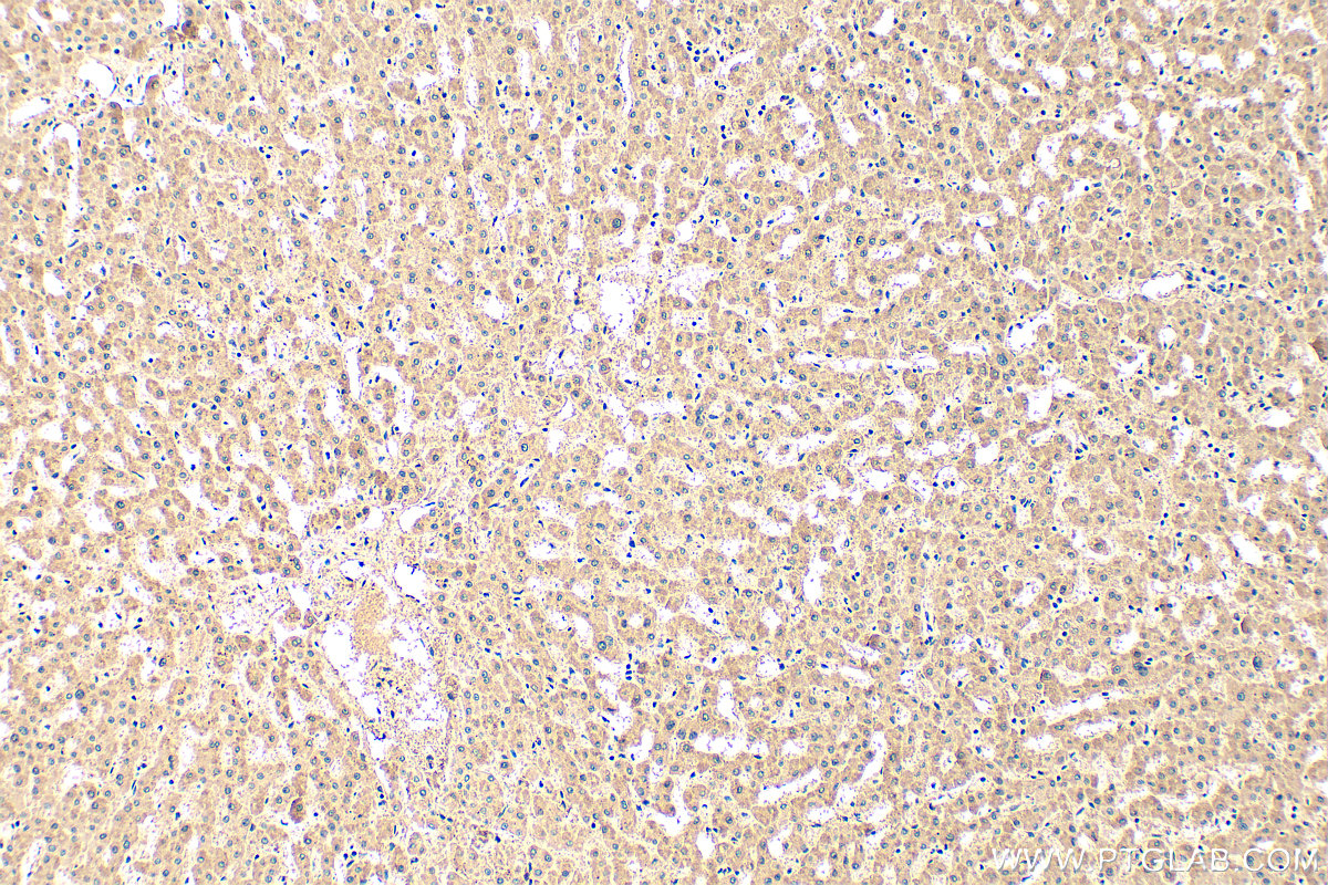 IHC staining of human liver using 25184-1-AP