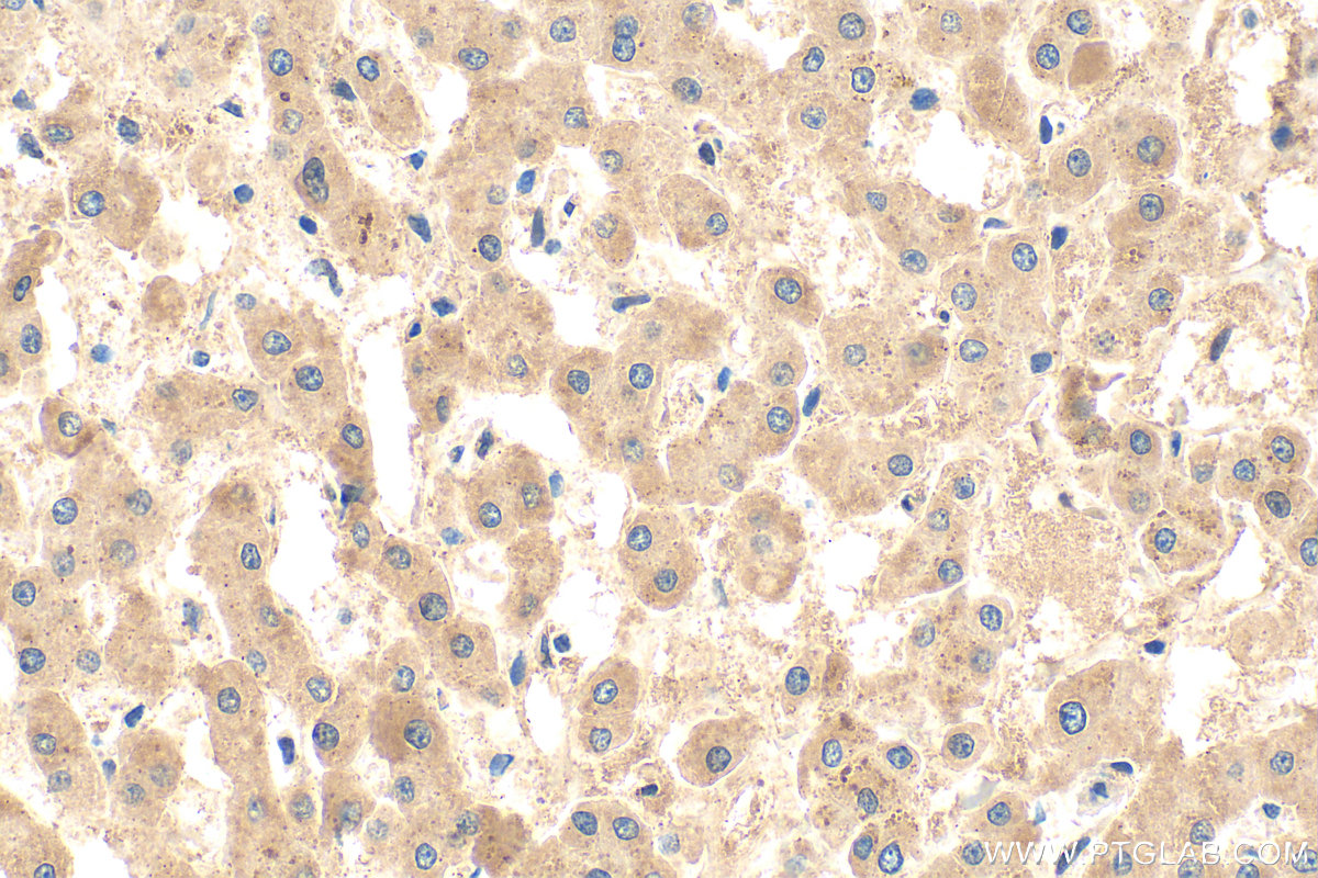 IHC staining of human liver using 25184-1-AP