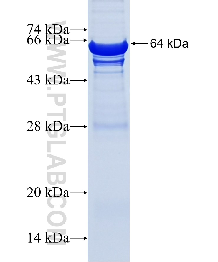 C8B fusion protein Ag18137 SDS-PAGE C8B fusion protein Ag18137 SDS-PAGE