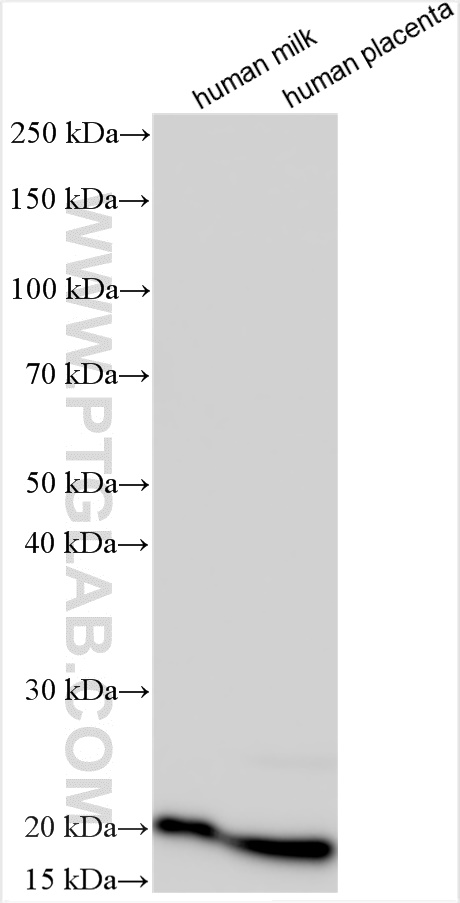 WB analysis using 27200-1-AP