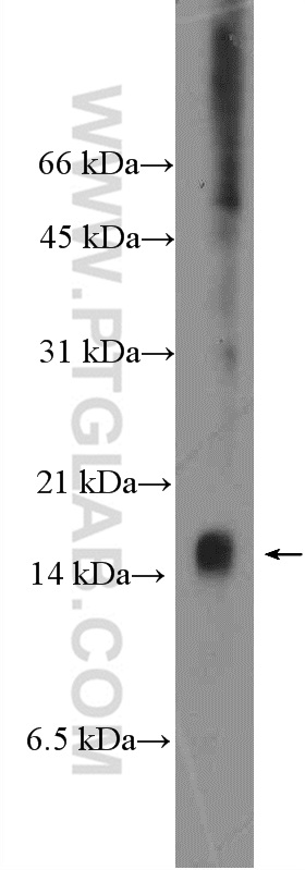 WB analysis of mouse kidney using 26279-1-AP