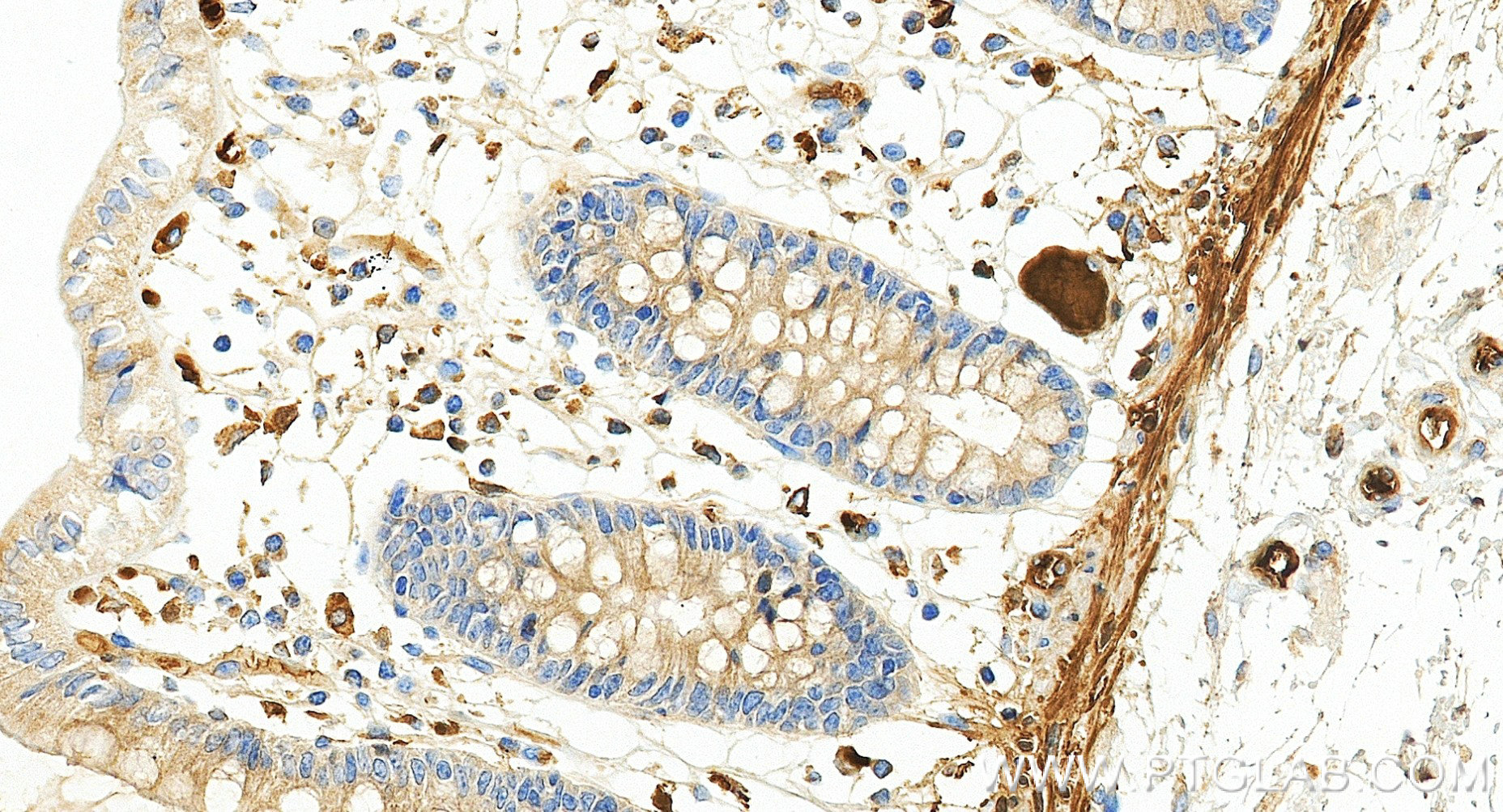 IHC staining of human colon using 84890-4-RR IHC staining of human colon using 84890-4-RR