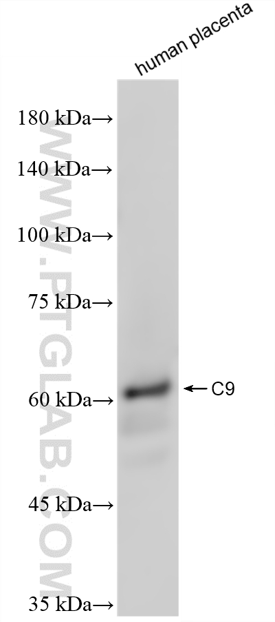 WB analysis of human placenta using 84890-4-RR WB analysis of human placenta using 84890-4-RR