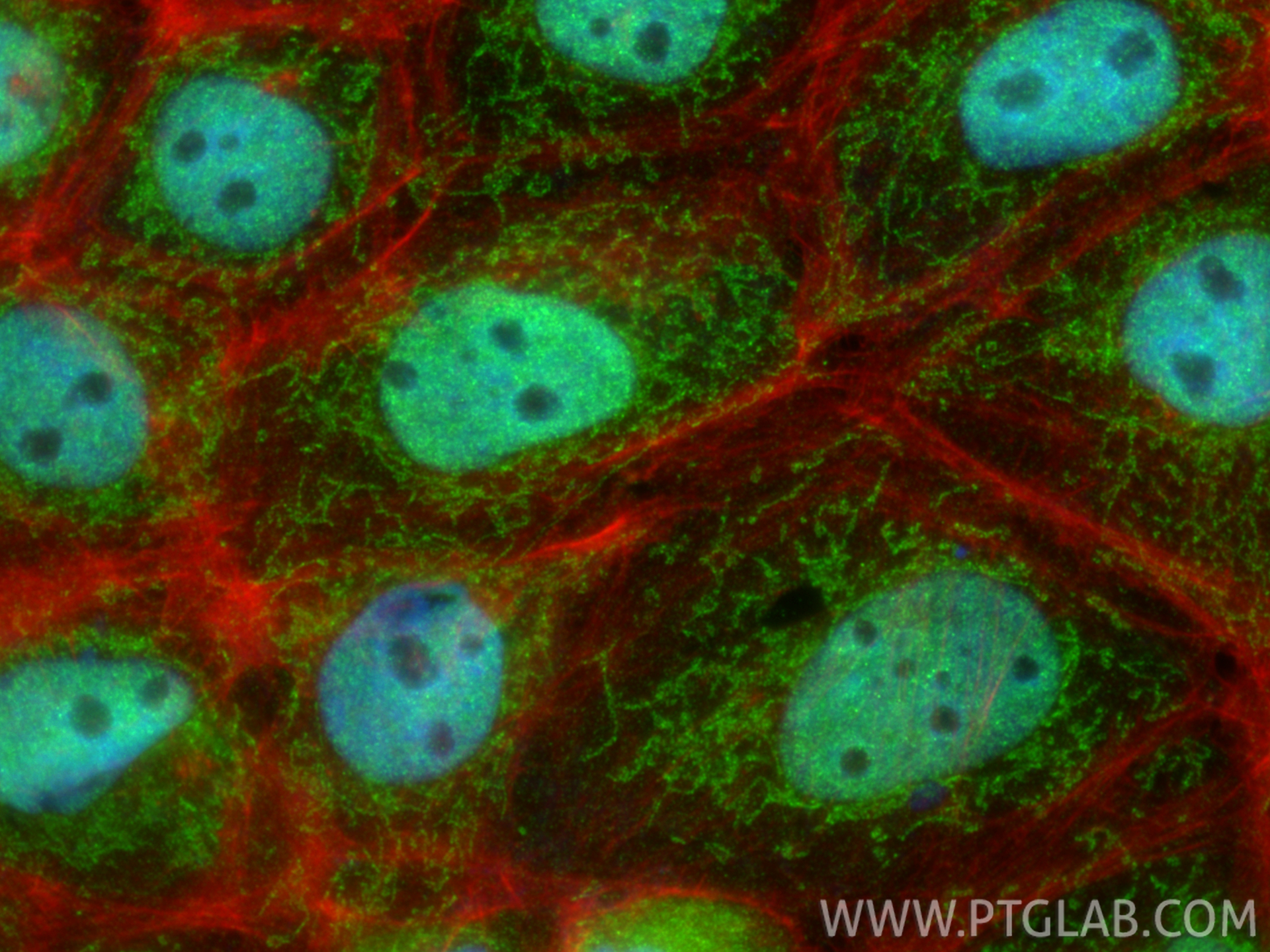 IF Staining of A431 using 27028-1-AP IF Staining of A431 using 27028-1-AP