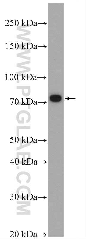 WB analysis of PC-3 using 27028-1-AP