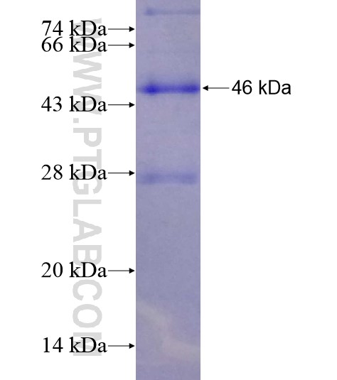 C9orf102 fusion protein Ag19375 SDS-PAGE C9orf102 fusion protein Ag19375 SDS-PAGE