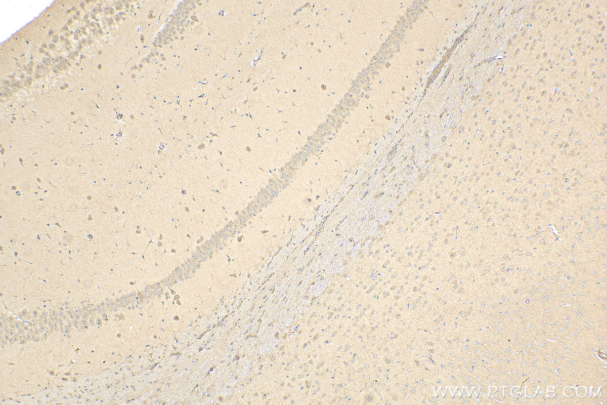 IHC staining of mouse brain using 21012-1-AP