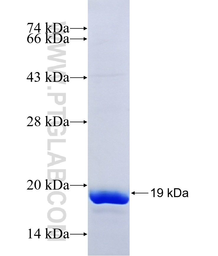 C9orf119 fusion protein Ag40940 SDS-PAGE C9orf119 fusion protein Ag40940 SDS-PAGE