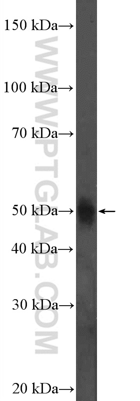 WB analysis of SH-SY5Y using 20620-1-AP