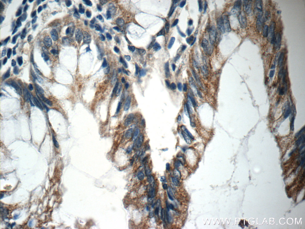 IHC staining of human colon using 21593-1-AP