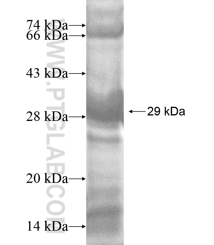 C9orf127 fusion protein Ag17034 SDS-PAGE C9orf127 fusion protein Ag17034 SDS-PAGE