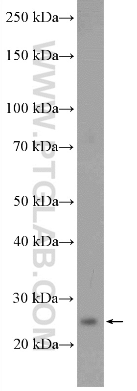 C9orf142