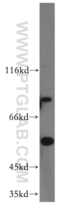 WB analysis of HeLa using 20475-1-AP