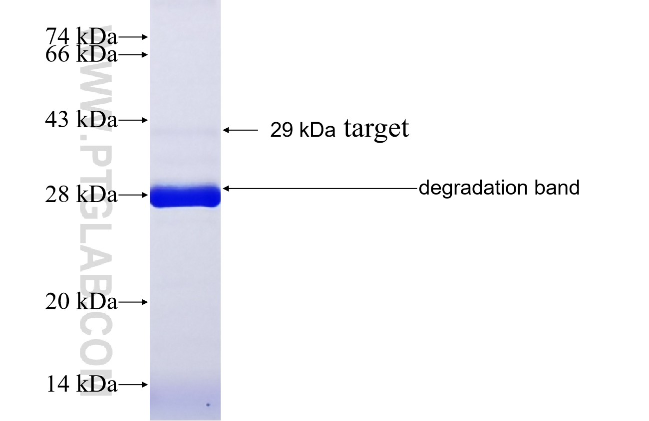 C9orf23 fusion protein Ag38630 SDS-PAGE