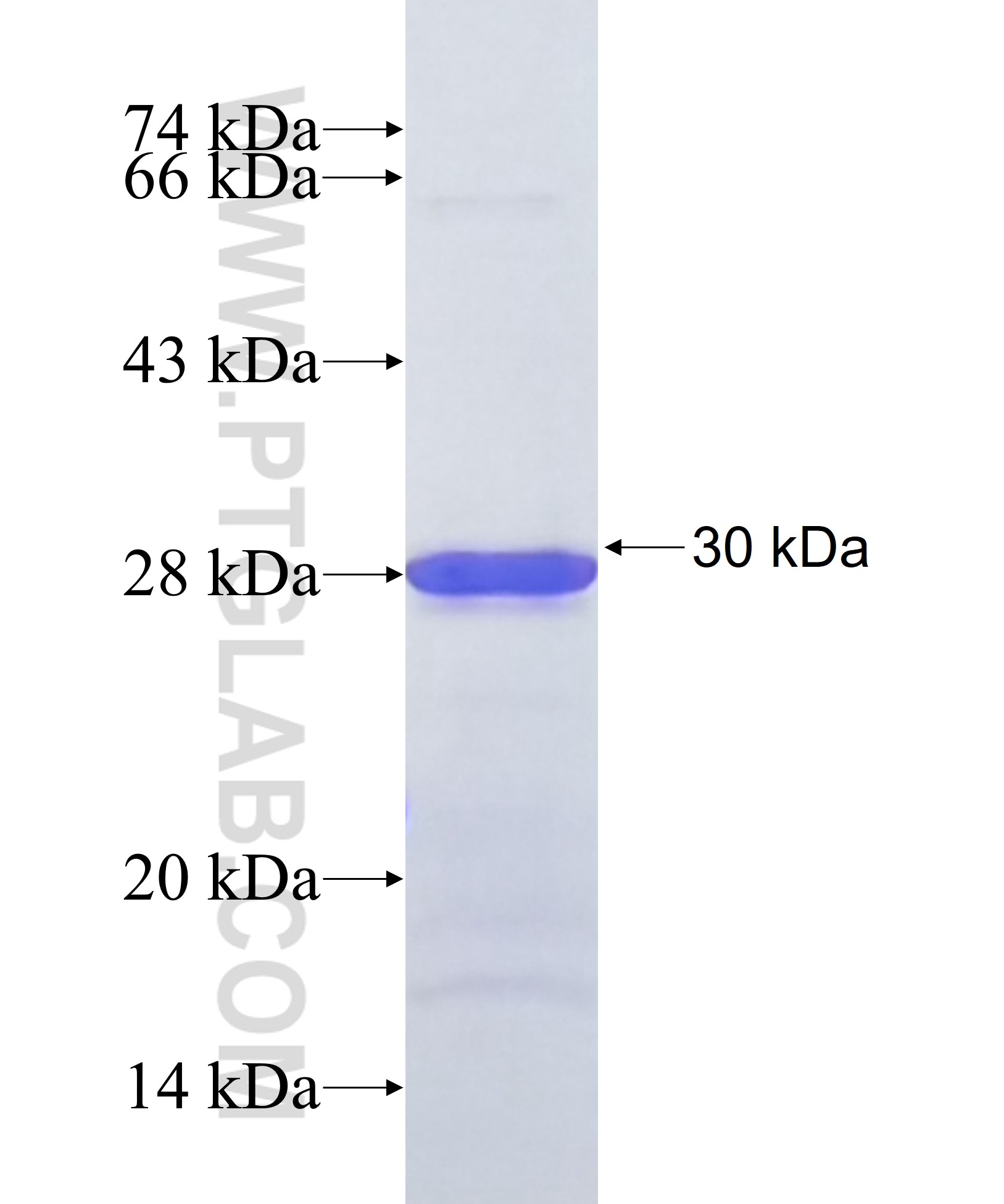 C9orf40 fusion protein Ag38101 SDS-PAGE C9orf40 fusion protein Ag38101 SDS-PAGE