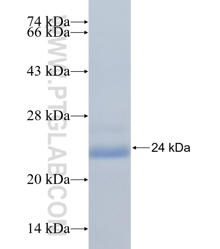 C9orf71 fusion protein Ag33081 SDS-PAGE C9orf71 fusion protein Ag33081 SDS-PAGE