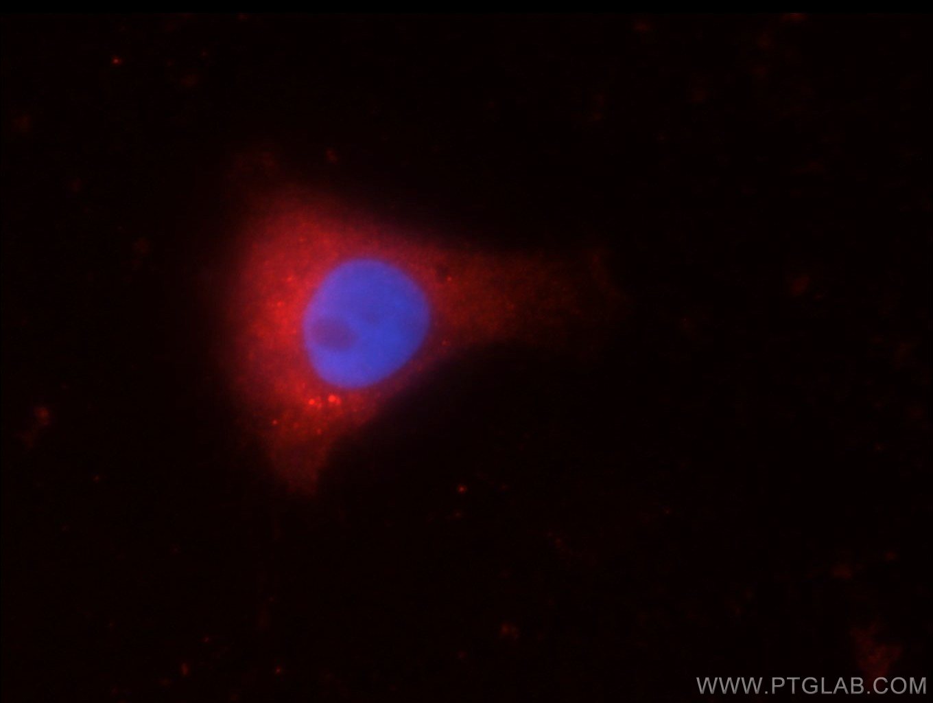 IF Staining of SH-SY5Y using 22637-1-AP