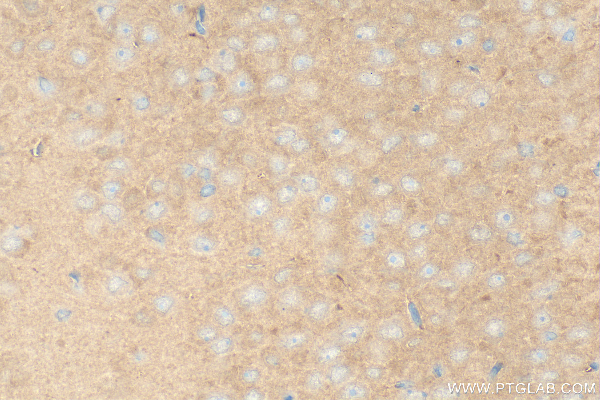 IHC staining of rat brain using 22637-1-AP