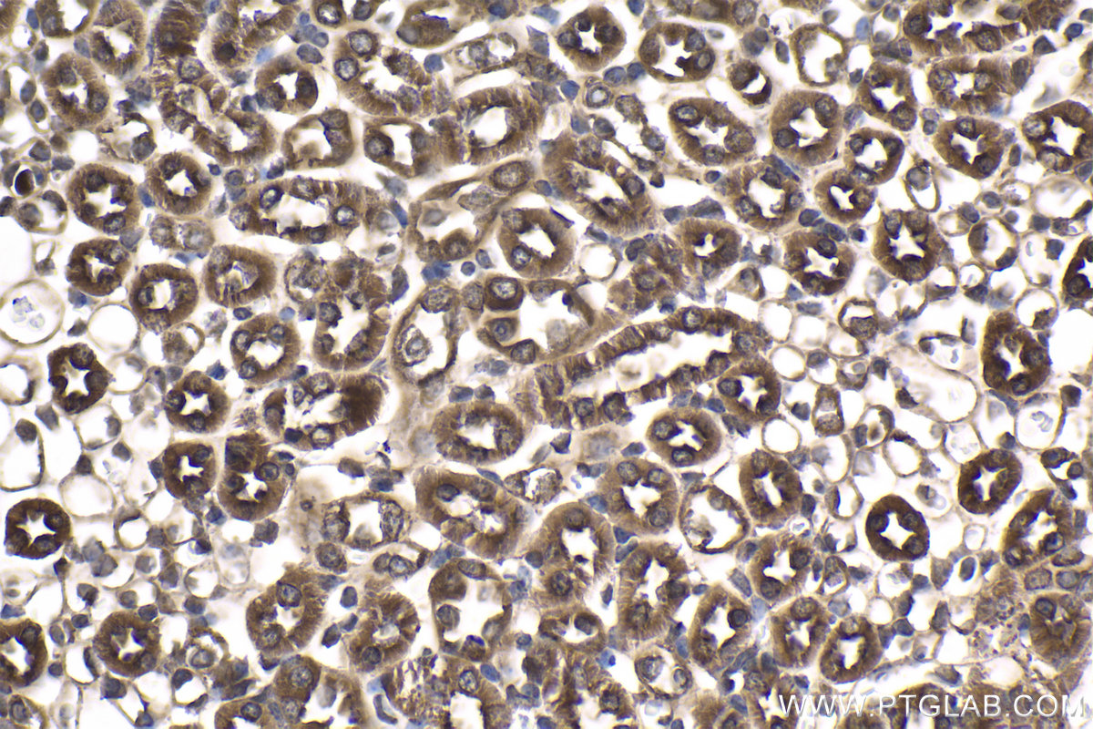 IHC staining of mouse kidney using 25757-1-AP