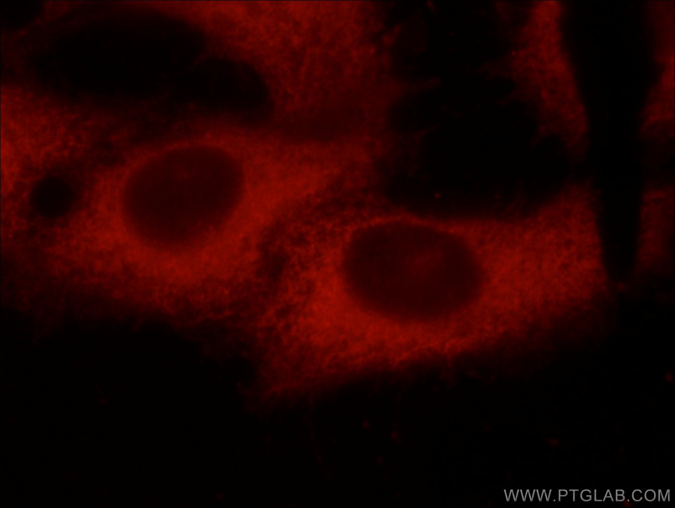 IF Staining of SH-SY5Y using 66140-1-Ig