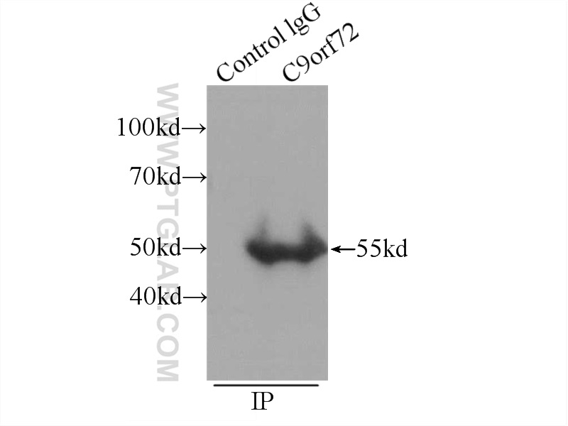 IP experiment of C6 using 66140-1-Ig