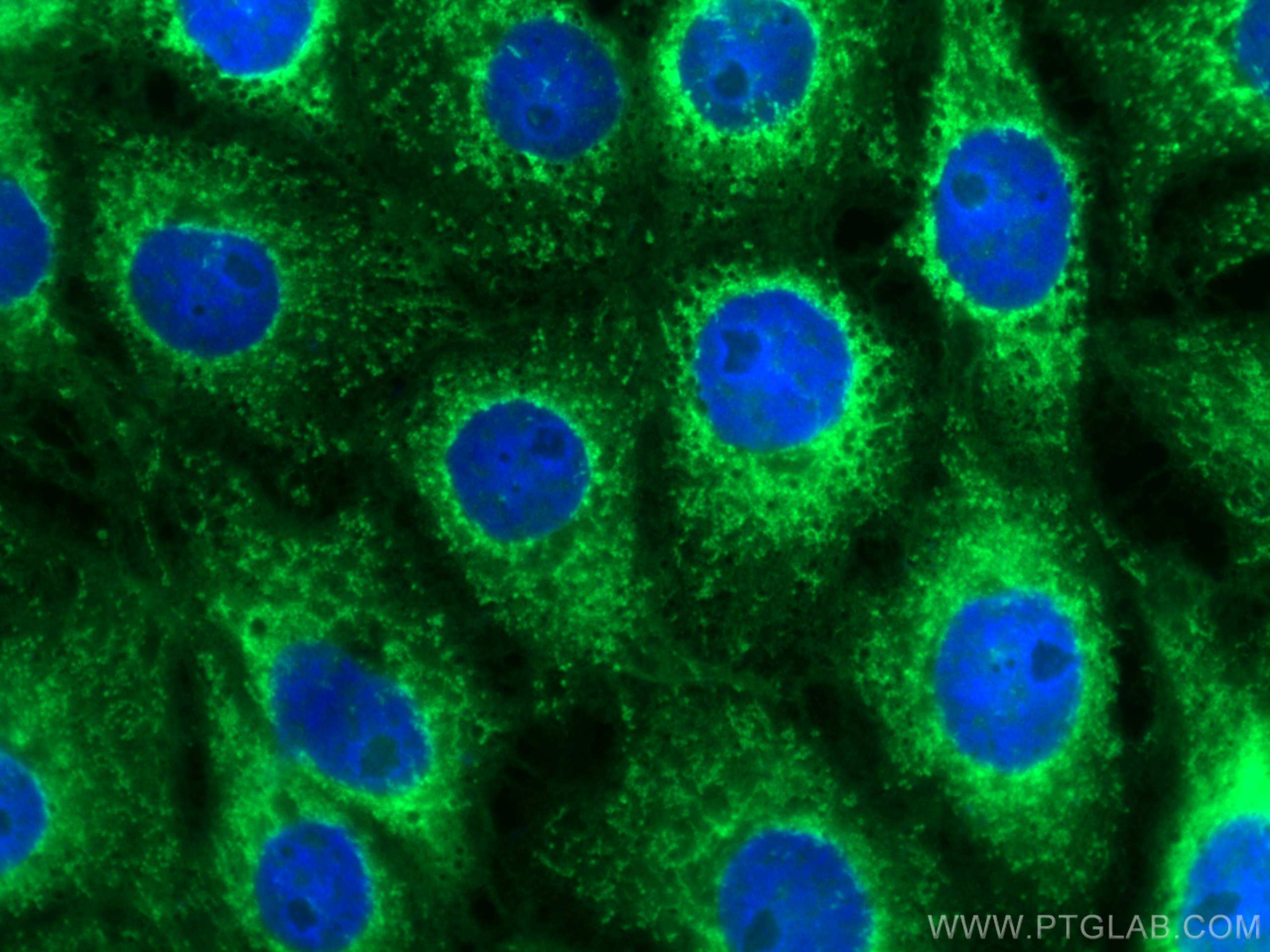 IF Staining of SH-SY5Y using CL488-66140