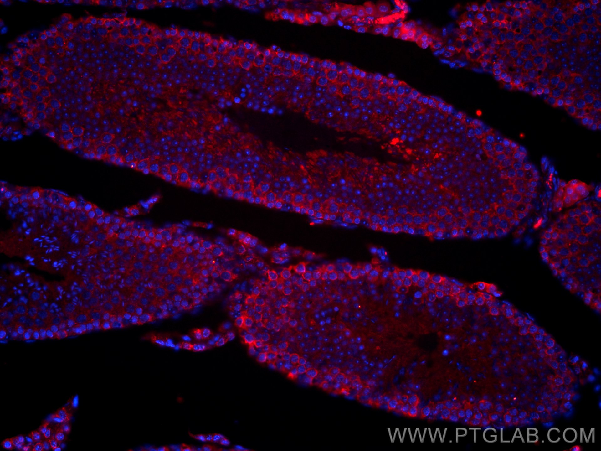 IF Staining of mouse testis using CL594-22637