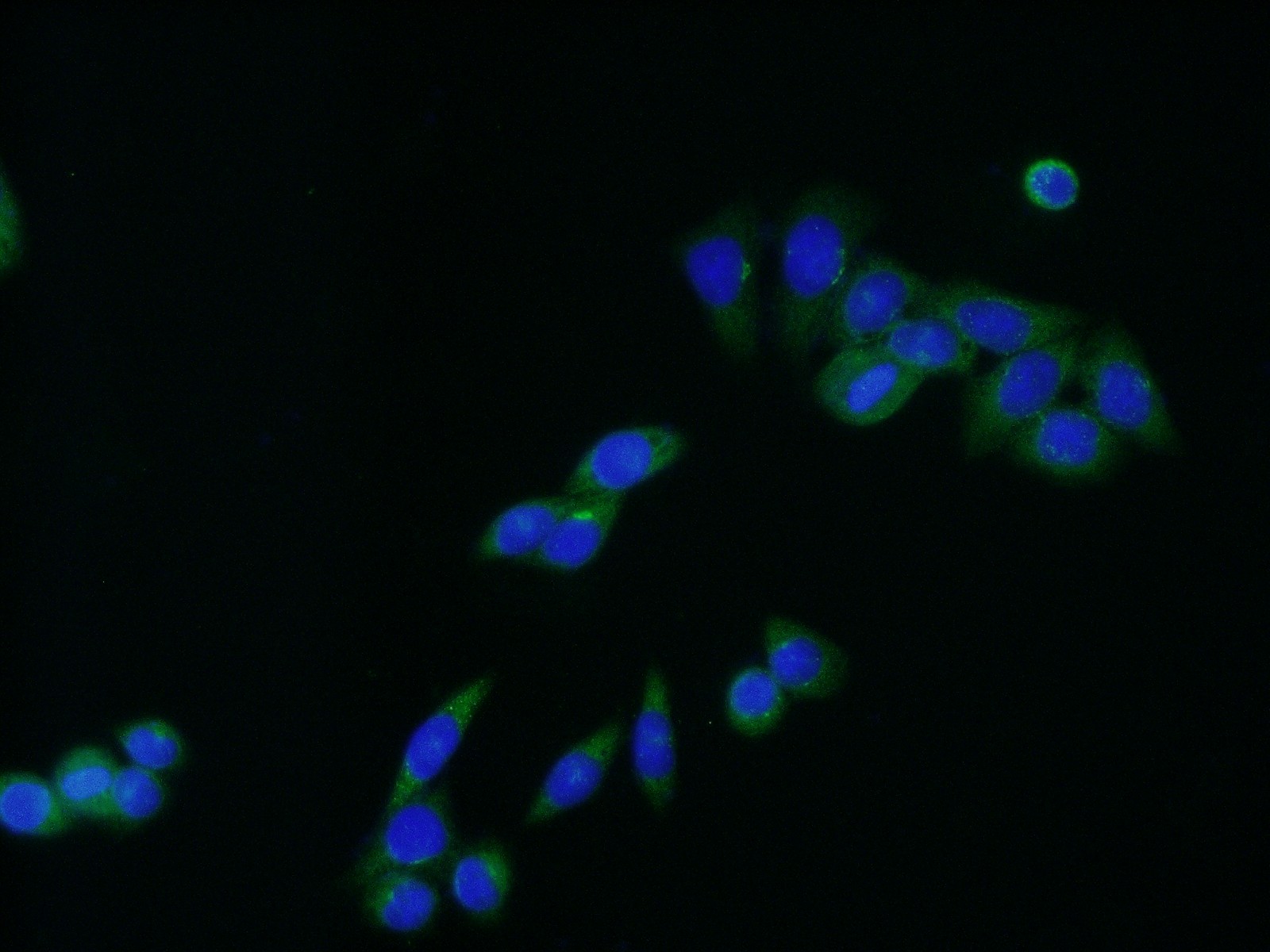 IF Staining of HeLa using 20848-1-AP