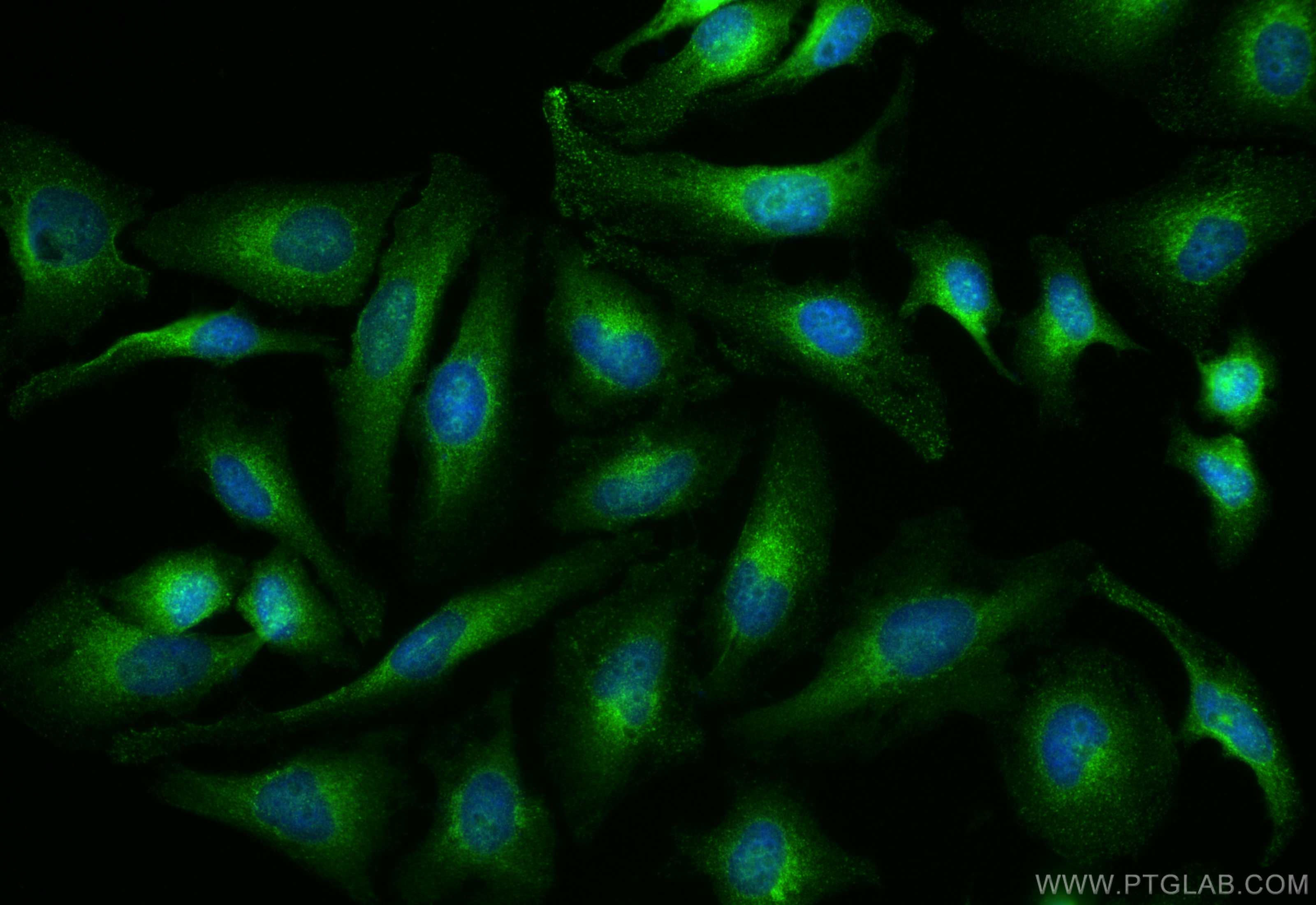 IF Staining of HeLa using 20848-1-AP