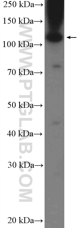 WB analysis of MDA-MB-453s using 20848-1-AP