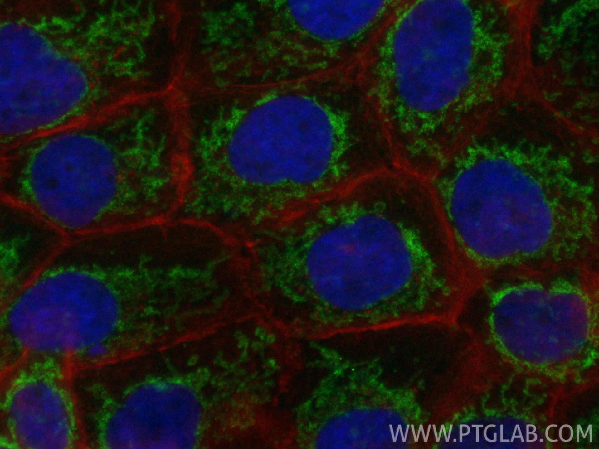 Immunofluorescent analysis of (4% PFA) fixed A431 cells using CoraLite® Plus 488 C9orf89 antibody (CL488-85357, Clone: 242638F7 ) at dilution of 1:200, CL594-phalloidin (red). IF Staining of A431 using CL488-85357