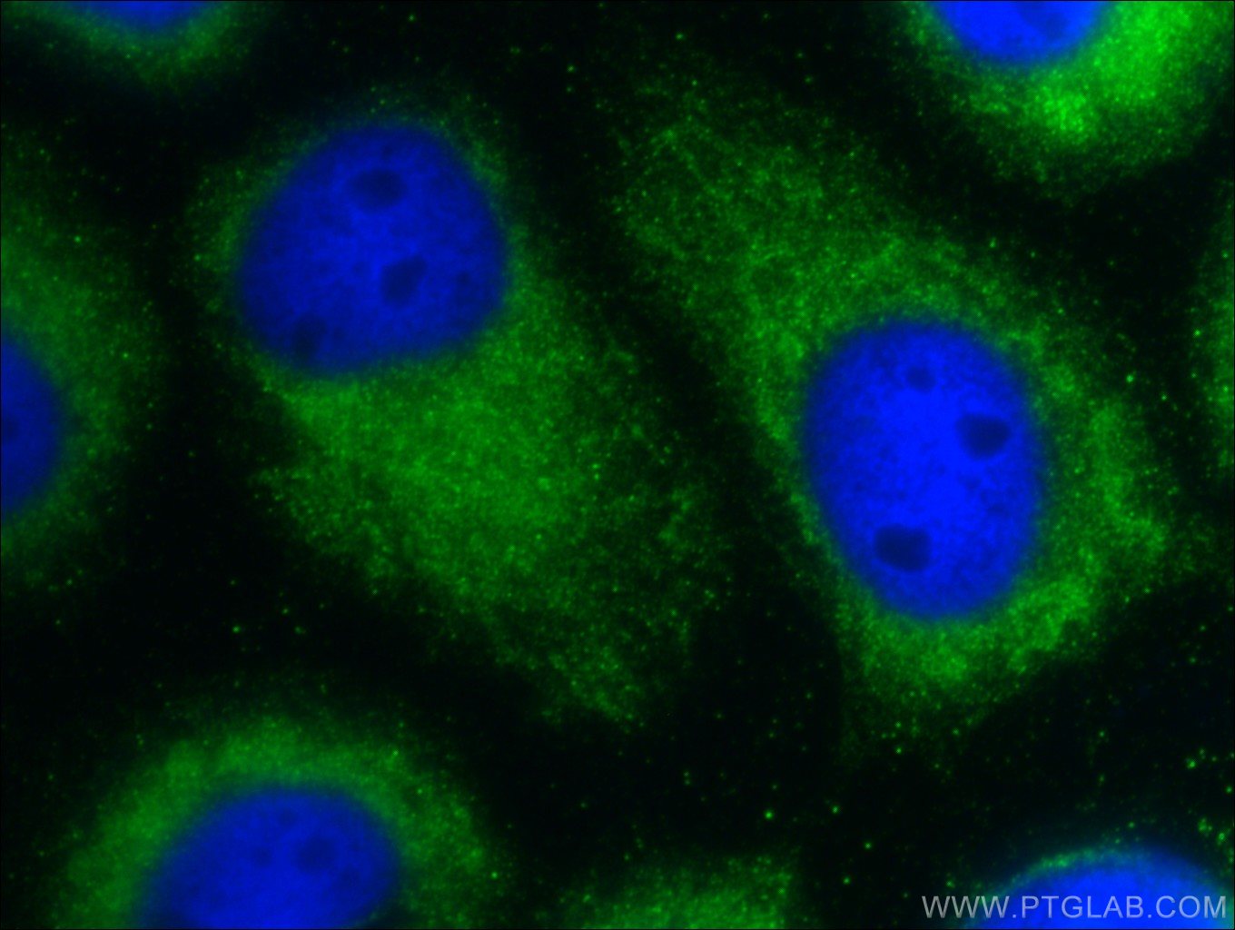 IF Staining of A431 using 26034-1-AP