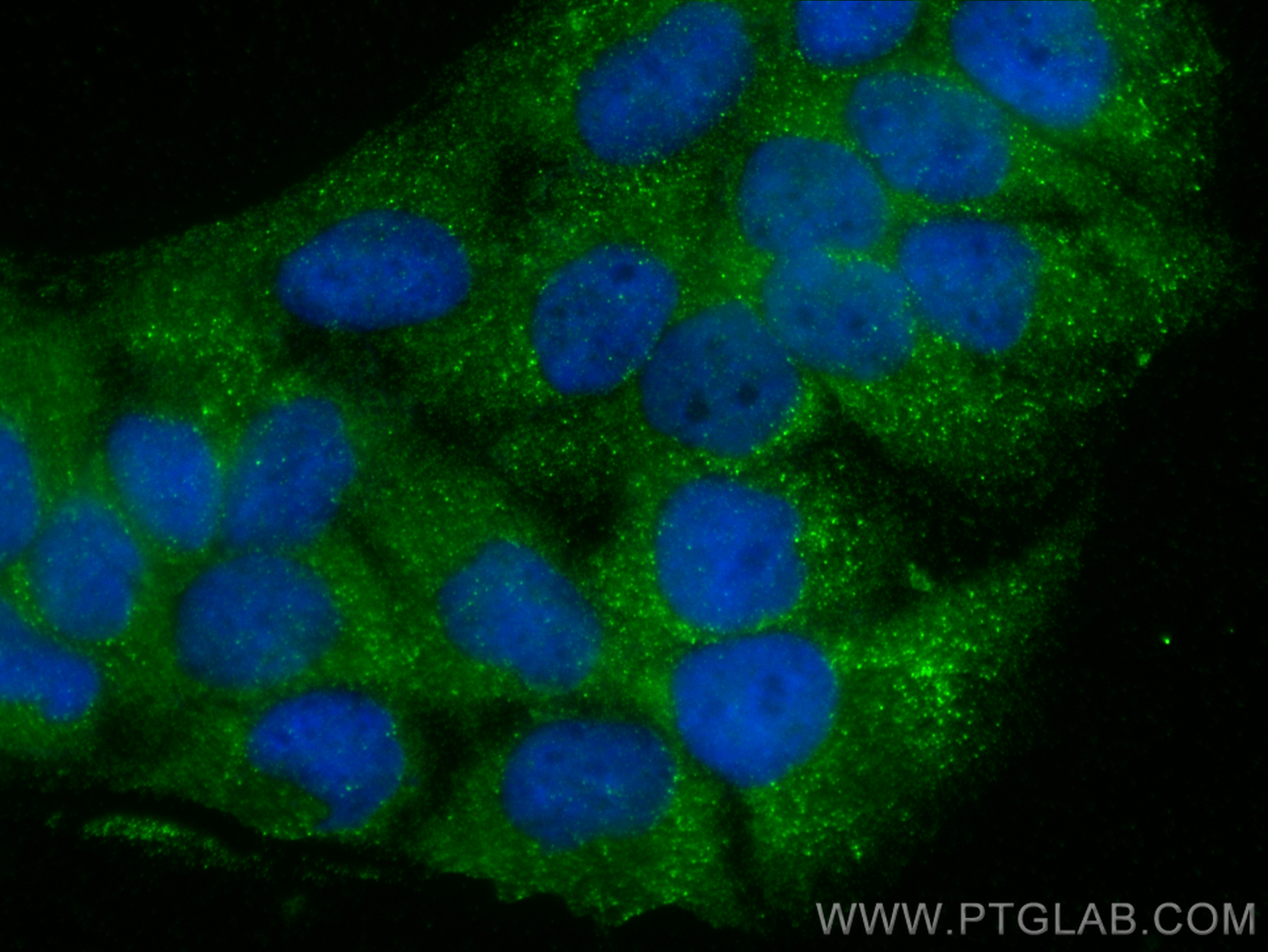 Immunofluorescent analysis of (-20°C Methanol) fixed HaCaT cells using SPACA9 antibody (26034-1-AP) at dilution of 1:400 and CoraLite®488-Conjugated Goat Anti-Rabbit IgG(H+L) (<a class='green' href='/productredirect?CatalogNo=SA00013-2' target='_blank'>SA00013-2</a>). IF Staining of HaCaT using 26034-1-AP