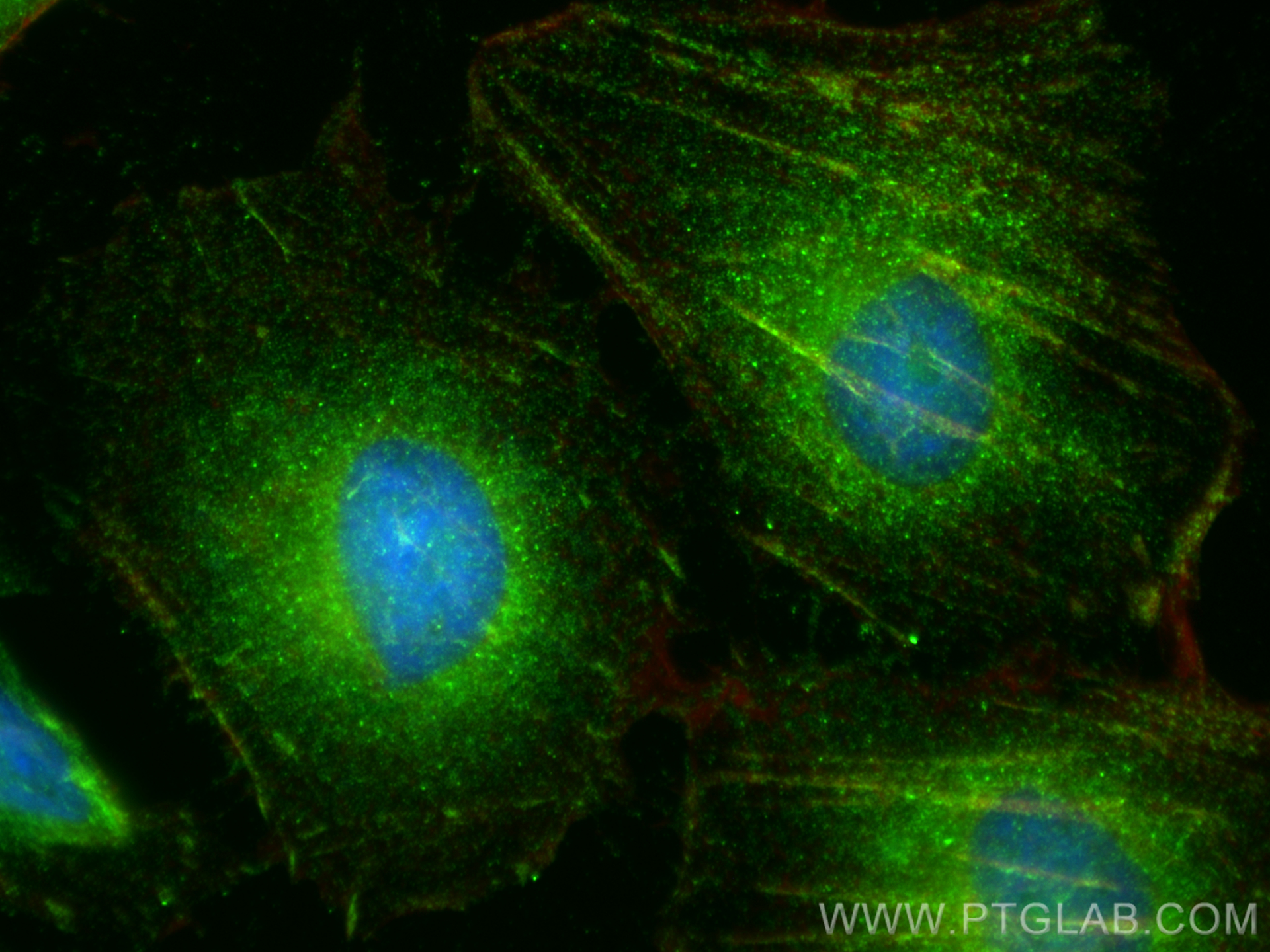 Immunofluorescent analysis of (-20°C Ethanol) fixed HeLa cells using SPACA9 antibody (26034-1-AP) at dilution of 1:400 and CoraLite®488-Conjugated Goat Anti-Rabbit IgG(H+L) (<a class='green' href='/productredirect?CatalogNo=SA00013-2' target='_blank'>SA00013-2</a>), CL594-Phalloidin (red). IF Staining of HeLa using 26034-1-AP