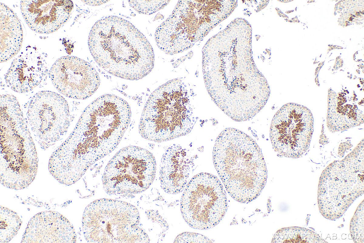 Immunohistochemical analysis of paraffin-embedded mouse testis tissue slide using 26034-1-AP (SPACA9 antibody) at dilution of 1:100 (under 10x lens). Heat mediated antigen retrieval with Tris-EDTA buffer (pH 9.0). IHC staining of mouse testis using 26034-1-AP