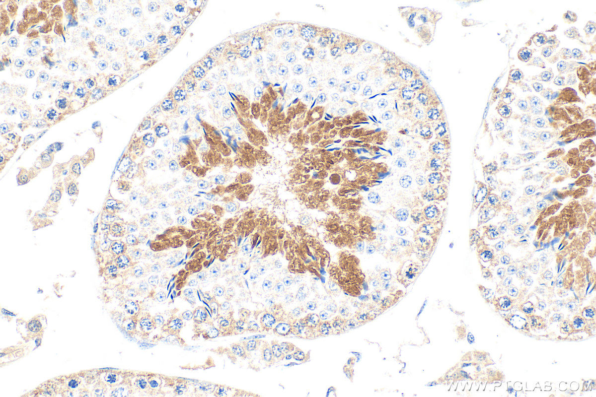 Immunohistochemical analysis of paraffin-embedded mouse testis tissue slide using 26034-1-AP (SPACA9 antibody) at dilution of 1:100 (under 40x lens). Heat mediated antigen retrieval with Tris-EDTA buffer (pH 9.0). IHC staining of mouse testis using 26034-1-AP