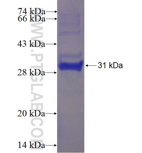 C9orf9 fusion protein Ag23328 SDS-PAGE C9orf9 fusion protein Ag23328 SDS-PAGE