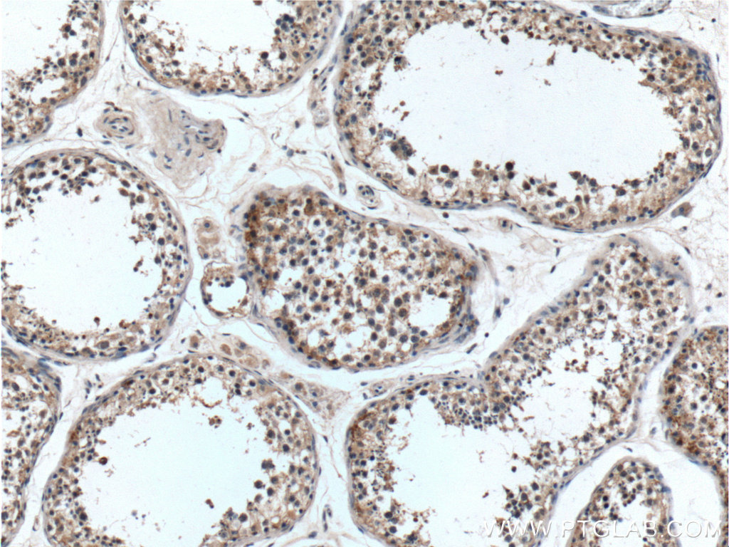 IHC staining of human testis using 21036-1-AP