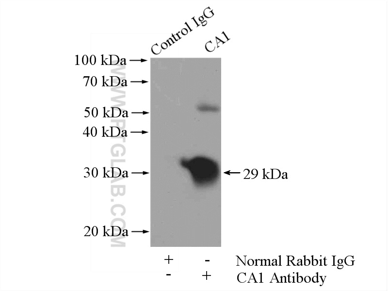 IP experiment of K-562 using 13198-2-AP