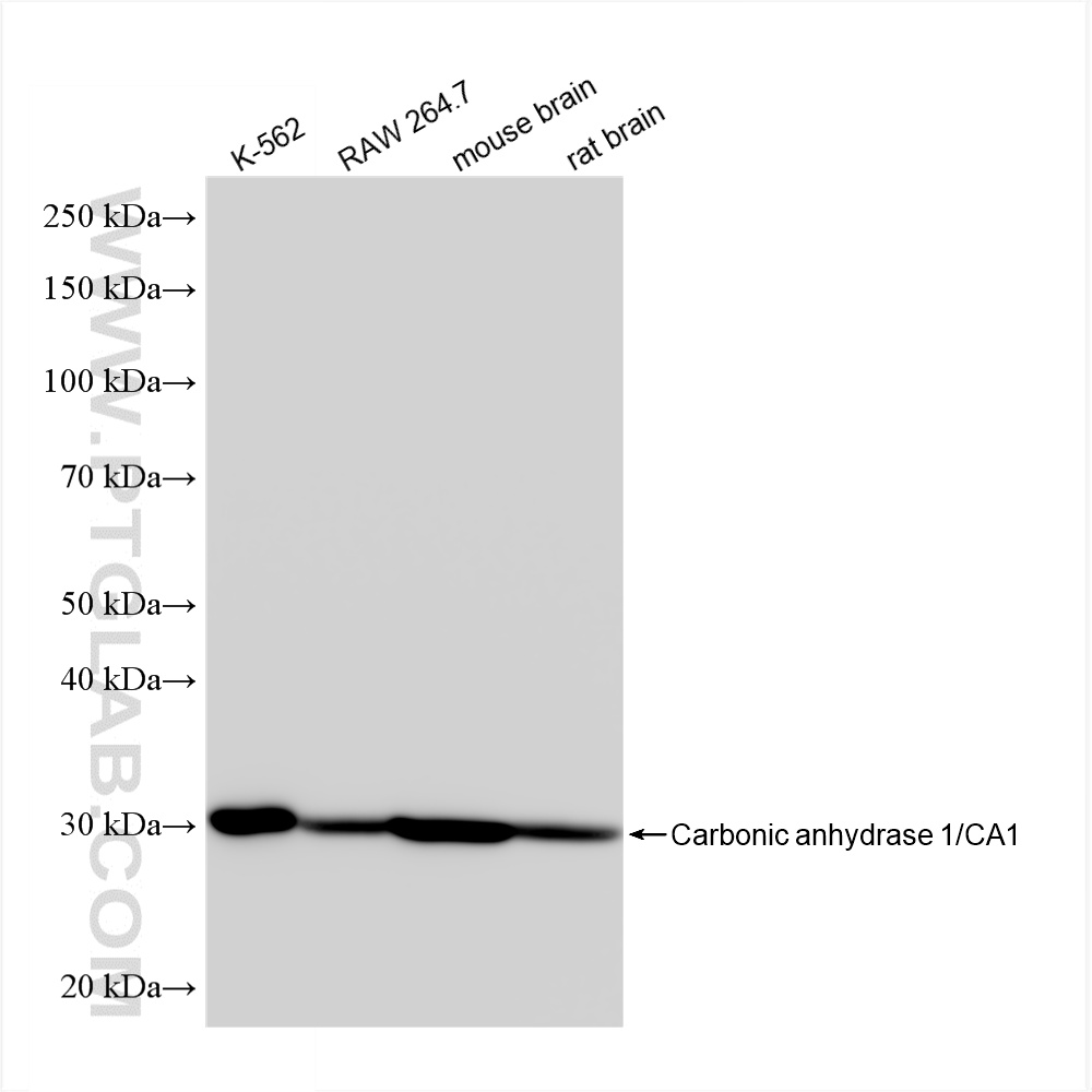 WB analysis using 86000-1-RR (same clone as 86000-1-PBS)