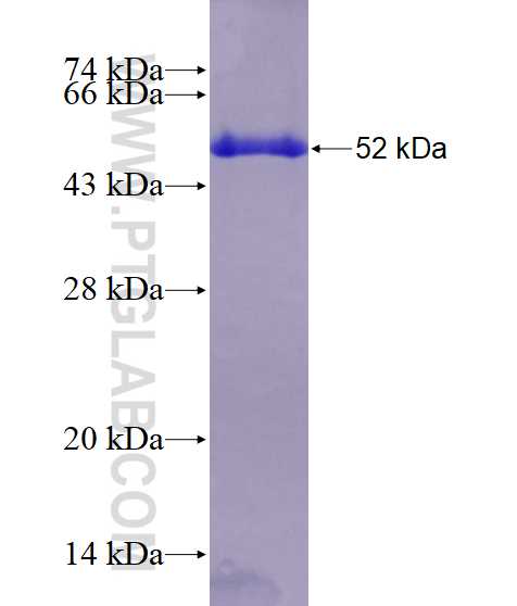 CA1 fusion protein Ag3932 SDS-PAGE