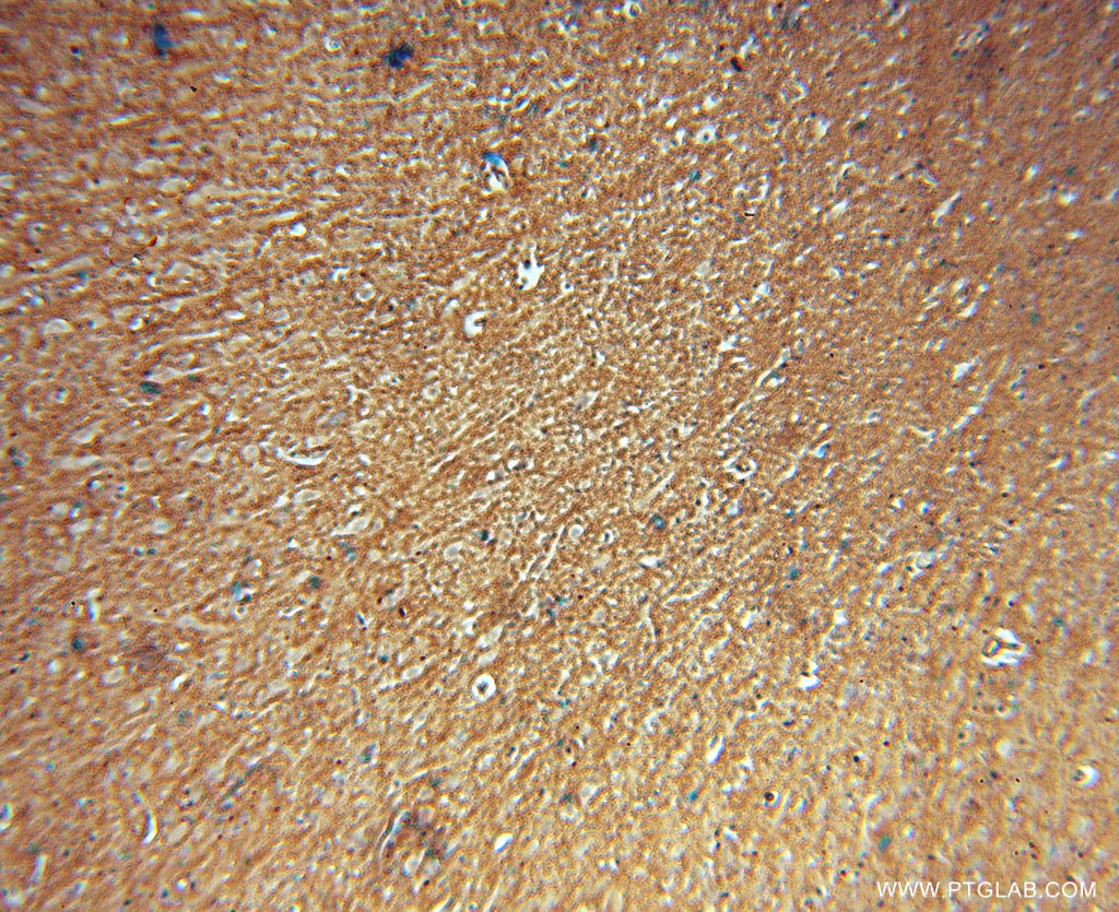 IHC staining of human brain using 15435-1-AP