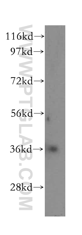 WB analysis of human kidney using 15435-1-AP